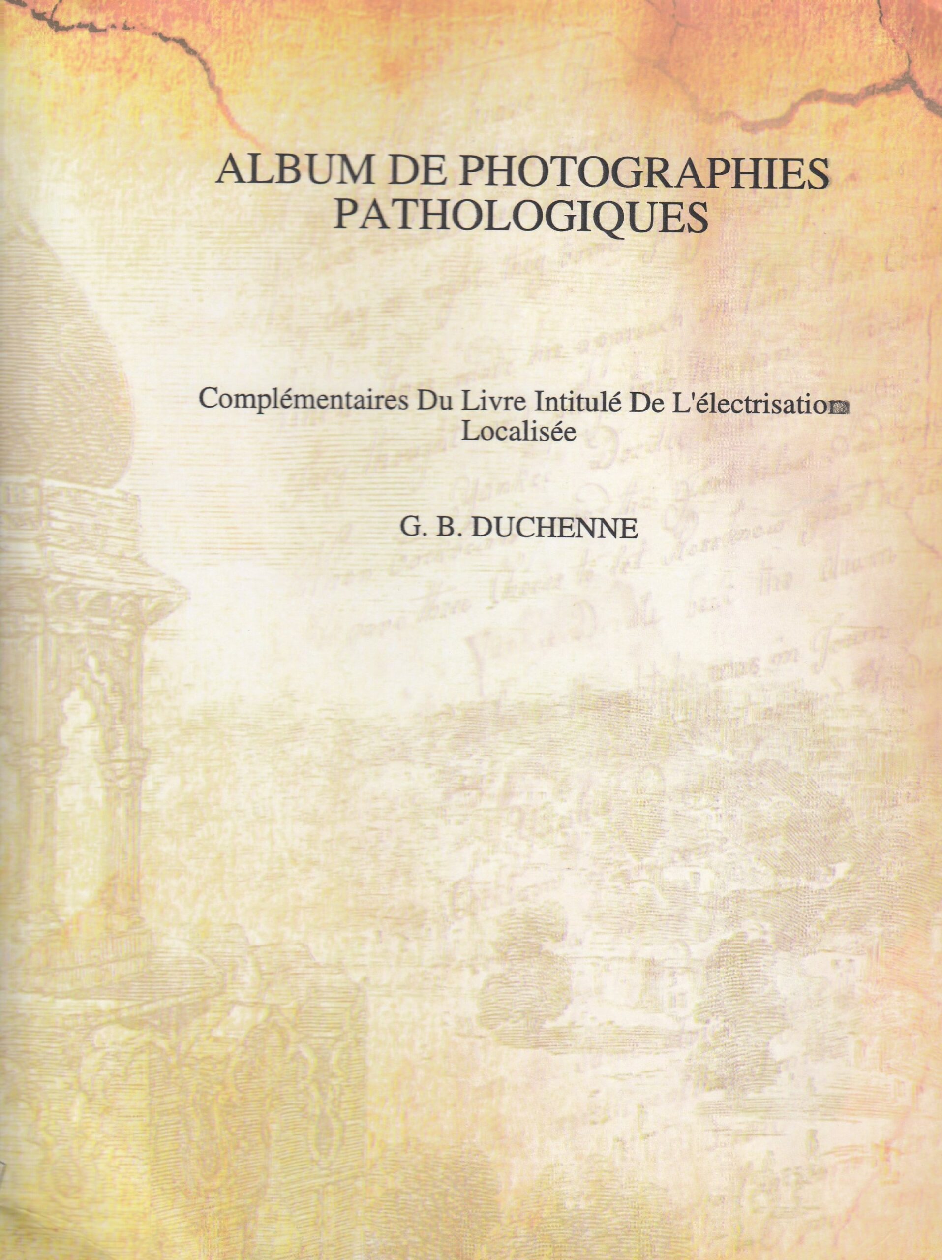 G. B. Duchenne : Album de photographies pathologiques